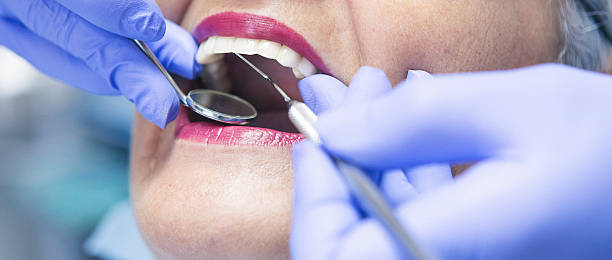 Best Emergency Treatment for Toothache in West Park, CA